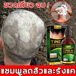 【1ขวด แก้ปัญหาเส้นผม】ยาสระผมเชื้อรา 100ML ป้องกันรังแคและลดความมัน บำรุงหนังศรีษะ ให้ผมเนียนนุ่ม ลดอาการคันศีรษะ shampoo