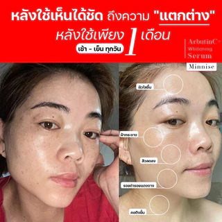 พิเศษ[1+1] 𝗠𝗶𝗻𝗻𝗶𝘀𝗲 𝗔𝗿𝗯𝘂𝘁𝗶𝗻𝗖+ เซรั่มลดฝ้ากระหน้าเงา โดสเข้มข้น