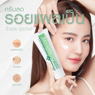 Smooth E Cream สมูทอี ครีม ลดสิว ลดรอยสิว สิวอักเสบ ลดเลือนริ้วรอย จุดด่างดำ รอยแผลเป็น ครีมลดรอย รอยเลเซอร์ ผิวแห้งลอก