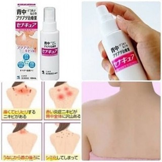 Kobayashi SenaCure Spray สเปรย์รักษาสิวและผื่นหลัง  ขนาด 100ml