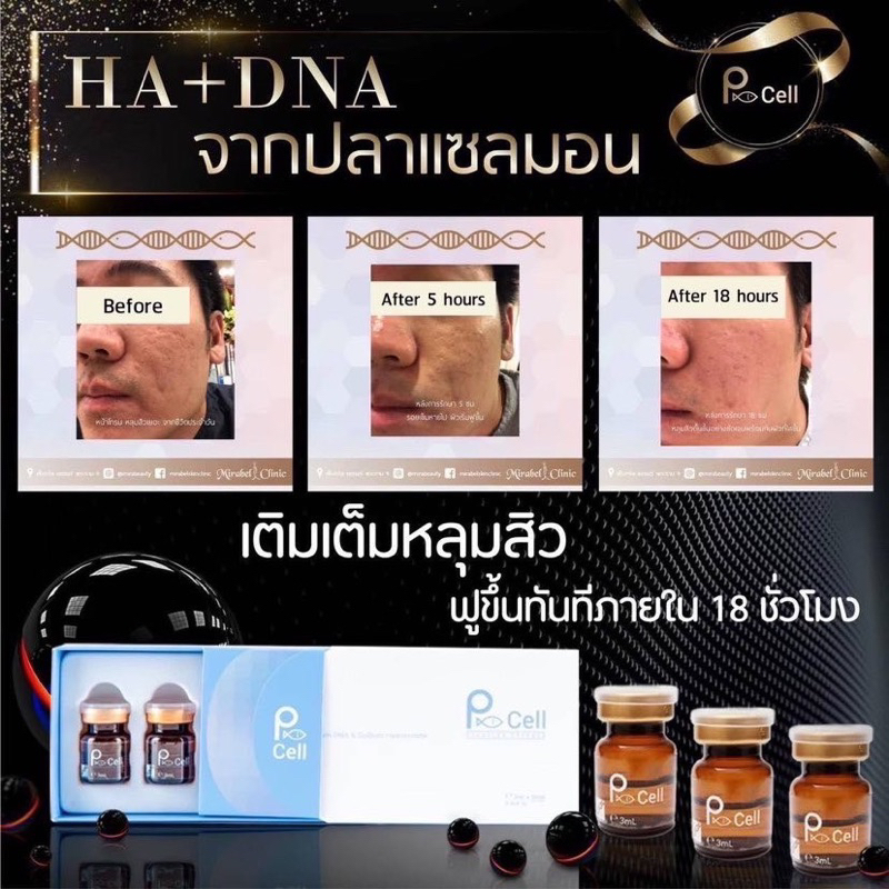 PCell PDRN หน้าใส ฉ่ำวาว รูขุมขนกระชับ 1 ขวด 3 ml