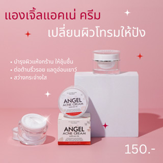 💥❣แองเจิ้ล แอคเน่ ครีม Angel Acne Cream ลดฝ้า กระ จุดด่างดำ