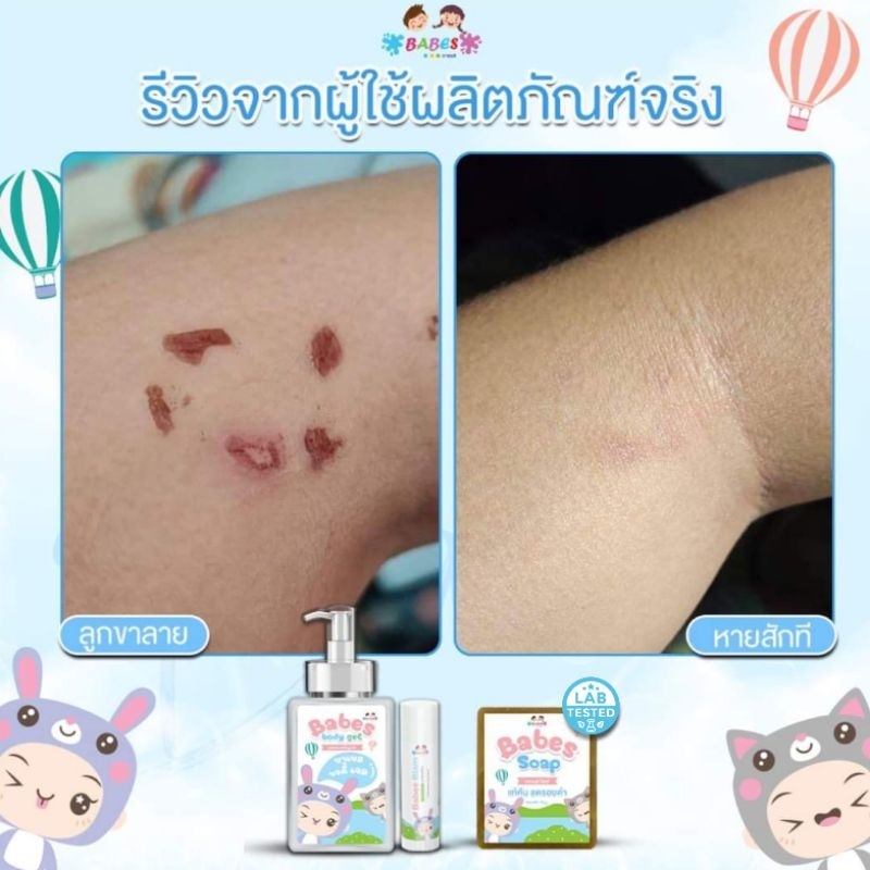 Thumbnail 9