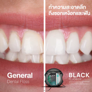 Dentiste Dental Black PTFE Floss Tape with Fluoride 30m ไหมขัดฟันเคลือบฟลูออไรด์ ขจัดคราบพลัค กลิ่นมิ้นท์