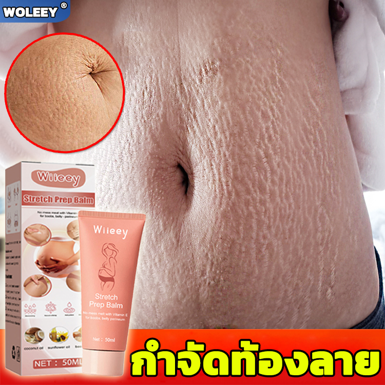 ครีมทาท้องลาย ผิวแตกลาย50g แก้ท้องลาย ลดรอยแตกลาย ขาแตกลาย สะโพกลาย ผิวลาย รอยแตกลาย ครีมลดรอยแตกลาย