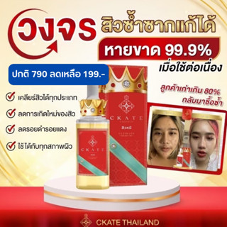 เซรั่มแก้สิว Ckate แท้100%