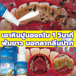 ⚡️เอาหินปูนออกใน 1 วินาที น้ำยากำจัดหินปูน 30ML ขจัดคราบหินปูน น้ำยากำจัดหินปูน ยาสีฟันฟอกฟันขาว Dental stone spray