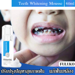 【พร้อมส่ง】NASSMEI มูสทำความสะอาดฟัน ขัดฟันขาว ลดครบหินปูน เสียวฟัน แก้คราบหินปูน บ้วนปาก มูสฟอกฟันขาว ยาสีฟันฟอกฟันขาว ฟอกฟันขาว ยาสีฟันฟันขาว ฟอกสีฟัน ลบคราบฟัน