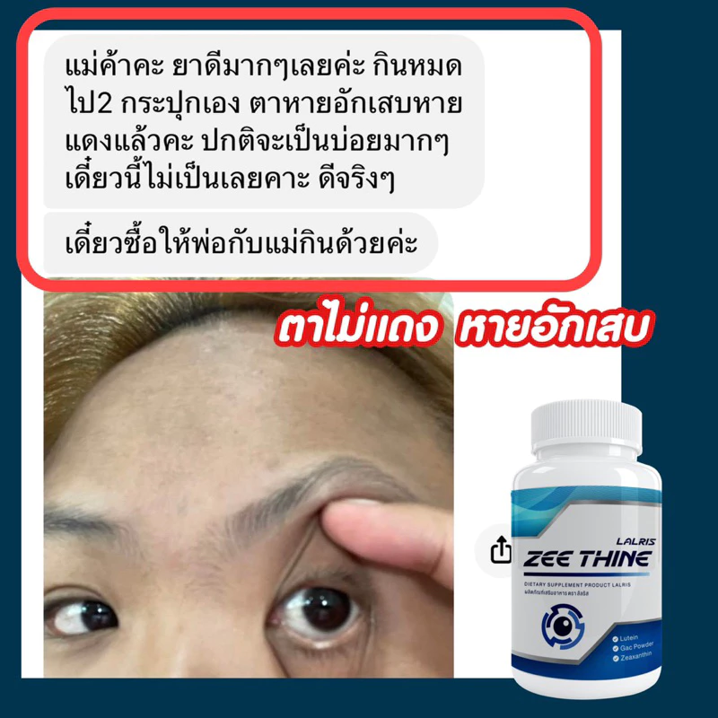 ซีทีนวิตามิน-Zee Thine 👁️บำรุงตา บำรุงสายตา สารสกัด ลูทีน บิลเบอรี่ Lutein Bilberry ซีแซนทีน Vitamin บำรุงดวงตา สายตา thumbnail 5