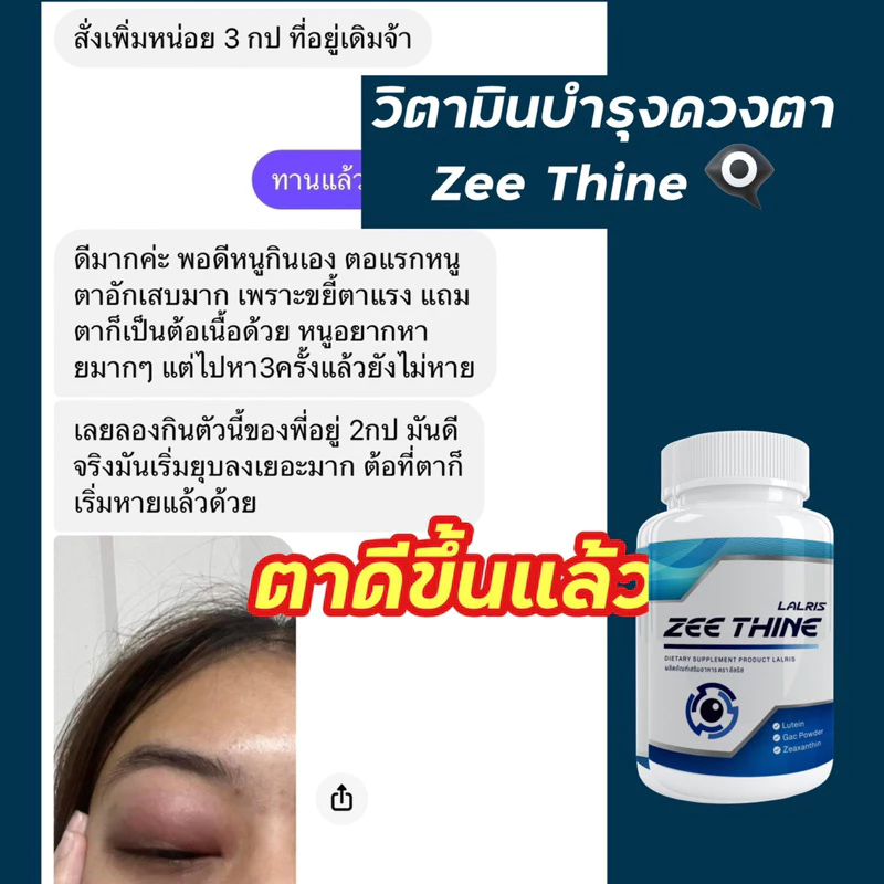 ซีทีนวิตามิน-Zee Thine 👁️บำรุงตา บำรุงสายตา สารสกัด ลูทีน บิลเบอรี่ Lutein Bilberry ซีแซนทีน Vitamin บำรุงดวงตา สายตา thumbnail 6