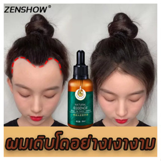 **ราคาส่ง 10ขวด**20ML เซ่รั่มปลูกผม เซรั่มเร่งผมยาว ลดผมล่วง ผมดกดำ มีน้ำหนัก ผมสวย ุนุ่มลื่น