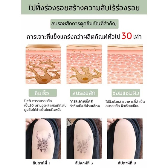 น้ำยาลบรอยสัก ครีมทาลบรอยสัก น้ำลบรอยสักคิ้ว ที่ลบรอยสัก ครีมรอยสัก น้ำลบรอยสัก ไม่ทำร้ายผิว ไม่มีแผลเป็น - รูปที่ 5