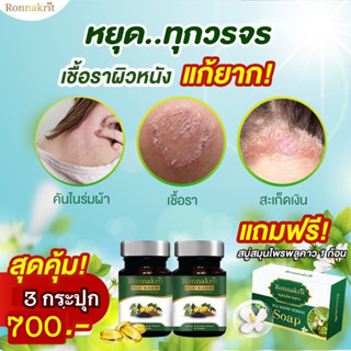 3แถม1 คุ้มๆ700-.รณกฤต3 สบู่ 1 สะเก็ดเงิน เชื้อรา ภูมิแพ้