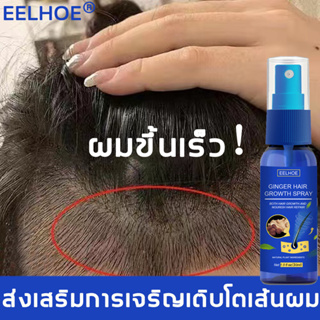 สเปรย์เซรั่มปลูกผม ผมขึ้นเร็ว EELHOE สเปรย์ปลูกผม30ml ส่งเสริมการเจริญเติบโตเส้นผม ลดผมร่วง(เซรั่มปลูกผม ป้องกันผมร่วง น