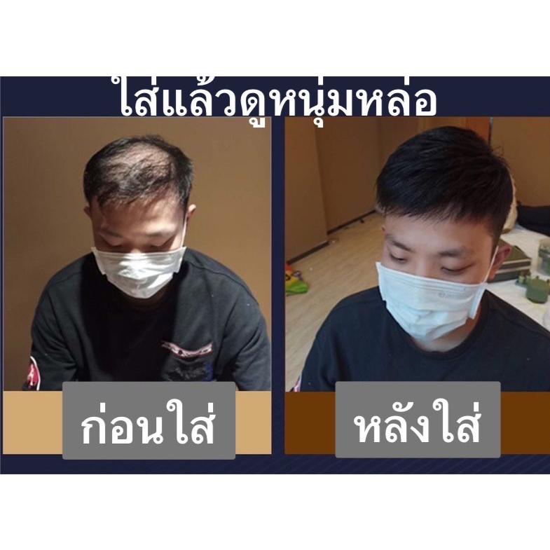 วิกผมปิดผมบางผมแท้ทอมือชาย ผมแท้100%ปิดผมบาง ติดกิ๊ฟได้ติดกาวได้