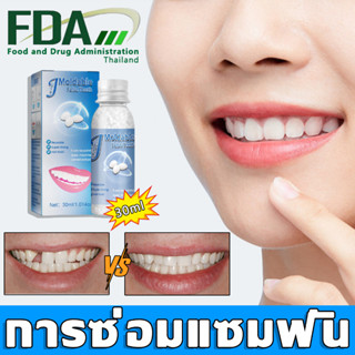 🦷อุดฟันเองที่บ้าน🦷ฟันปลอม ครอบฟันถอดได้ ชุดกาวฟันปลอมชั่วคราว(ฟันยาง ฟันปลอมของแท้ ชุดซ่อมฟัน ฟันปลอมซิลิโคน)