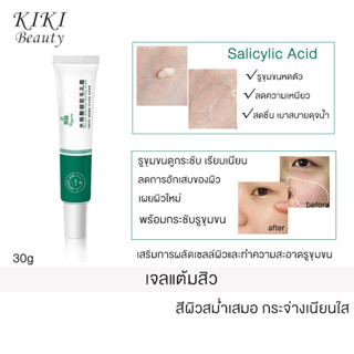 กรดซาลิไซลิกต่อต้านการรักษาสิว เจลกำจัดสิว Salicylic Acid Anti Acne Treatment 30g