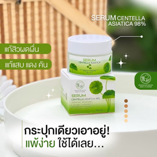 [พร้อมส่ง+มีของแถม]เซรั่มใบบัวบกพรทิน่า ผิวแพ้ง่ายใช้ได้ ลดสิว หน้าใส(ซื้อ1 กระปุกได้ของแถม=2ชิ้น เช่น กิ๊ฟช็อป)