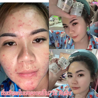 พร้อมส่ง🩷ครีมเอลลี่โมเมของแท้ ลดสิว ฝ้า กระ หน้าขาวกระจ่างใส ขนาด10กรัม~มีของแถม