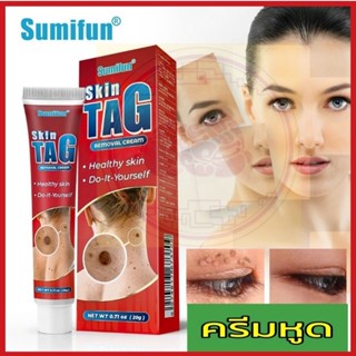 Sumifun ครีมสลายหูด ไฝและติ่งเนื้อ แคลรัสและรากหนาม ลอกหูดตาปลา แถมฟรี!แผ่นแปะหูดติ่งเนื้อ ครีมทาหูดหลอดสีแดง