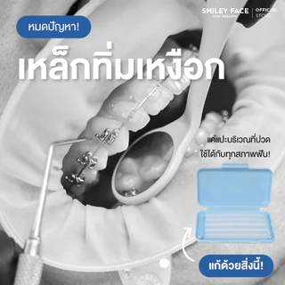 (กลิ่นมิ้น) ขี้ผึ้งจัดฟัน | Orthodontic Wax Kit