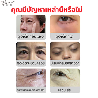 【ของแท้ พร้อมส่ง】ครีมบำรุงรอบดวงตา 20G ดูแลรอบดวงตาและ ครีมลดถุงใต้ตา ลดรอยคลำ้ใต้ตาลด ริ้วรอย