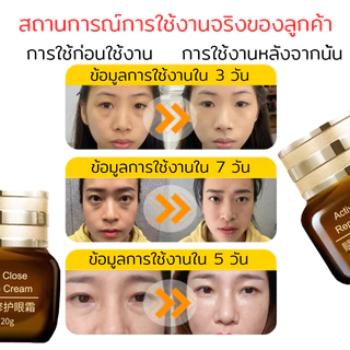【ของแท้ พร้อมส่ง】ครีมบำรุงรอบดวงตา 20G ดูแลรอบดวงตาและ ครีมลดถุงใต้ตา ลดรอยคลำ้ใต้ตาลด ริ้วรอย