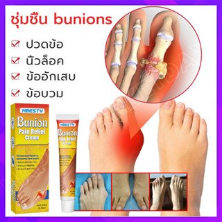 Bunion cream ลดปวด ลดอักเสบ นิ้วโป้งโค้งงอเข้า Hallux valgus ปวดเท้า ปวดข้อ ปวดบวม ข้ออักเสบ ข้อบวม ข้อต่อนิ้วเท้า