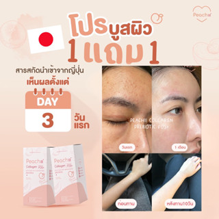 [1แถม1สุดคุ้ม💥] คอลลาเจนบูทผิวใส ลด สิว สารสกัดนำเข้าจากญี่ปุ่น🇯🇵 ผิวสุขภาพดีAll in one