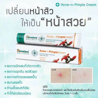 ครีมแต้มสิว 20g Himalaya Pimple Clear Cream