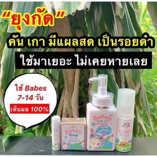 สำหรับเด็ก : babes บาเบส บาล์มแก้คัน ขาลาย แพ้ยุง บอดี้เจล สบู่ ลดอาการคัน แพ้ยุง ลดรอยแตกลาย ผิวแพ้ง่าย