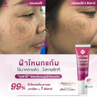 8G l ครีมทาฝ้า ลดฝ้า Melamii Anti-Melasma Perfect White Serum and Spot Corrector