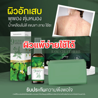 ส่งฟรี| สเปรย์รักษาสังคัง กลากเกลื้อน เชื้อราในร่มผ้า เชื้อราหนังศรีษะ สะเก็ดเงิน น้ำเหลืองไม่ดี ผิวแพ้ง่ายใช้ได้