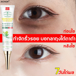 AICHUN อายครีม 30ml ครีมทาถุงใต้ตา ลดริ้วรอยรอบดวงตา ลดถุงใต้ตา ครีมบำรุงใต้ตา ยกกระชับ เม็ดไขมัน ดูแลรอบดวงตา