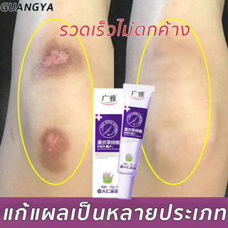 ครีมแผลเป็น 20g ครีมลดรอยแผลเป็นลดแผลไฟไหม้แผลน้ำร้อนลวกแผลผ่าตัดเป็นต้นแผลเป็นหลายประเภทลอยแผลเป็นครีมลดแผลเป็น