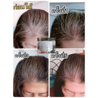 มาร์คปิดหงอกนวัตกรรมใหม่ล่าสุด​ของ4YL​T