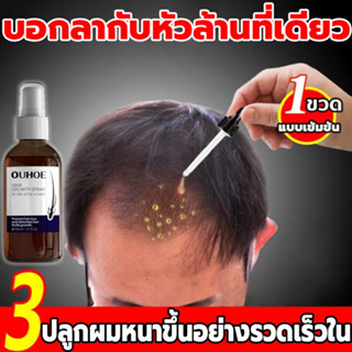 【บอกลาหัวล้าน ปลูกผมหนา ช่วยลดผมร่วง 】สเปรย์ปลูกผมOUHOE ยาปลูกผม ป้องกันผมร่วงน้ำยาเร่งผมยาว น้ำยาปลูกผม เร่งผมยาวไว แก้