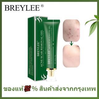 🌷แท้ / พร้อมส่ง🌷BREYLEE เจลแต้มสิว ลบรอยสิว ยาลดสิว ปรับผิวขาวใส ครีมทาแผลเป็น เจลบำรุงผิว ลบรอยสิวโดยไม่ทิ้งรอย ทีทรีเจลรักษาสิว และลดรอยแผลเป็นจากสิว