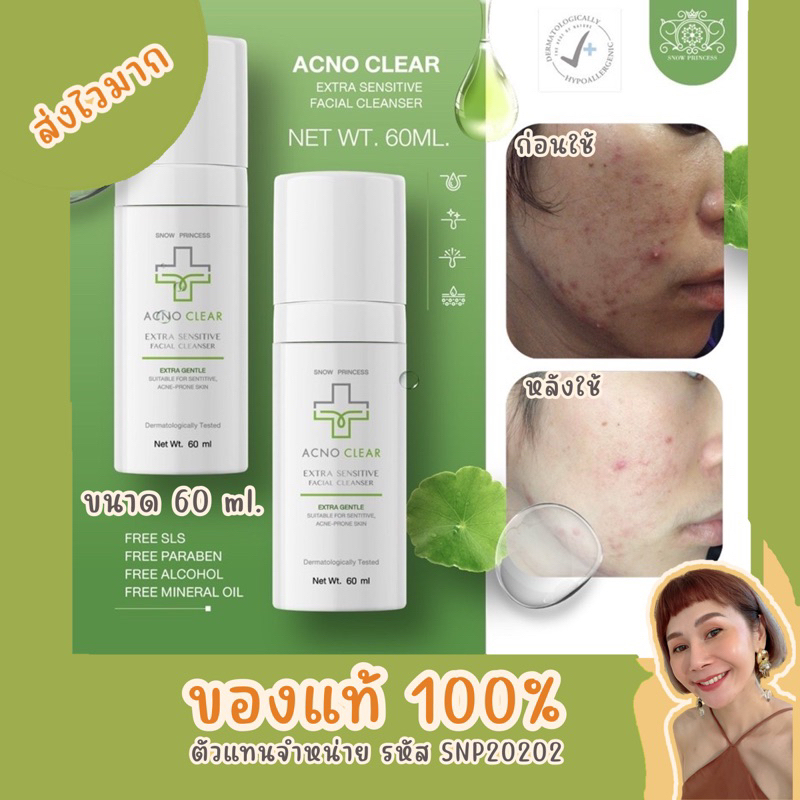 🔥🔥ส่งฟรี 🔥🔥ของแท้ 💯% Acno Clear แอคโน่เคลียร์ snow princess  #ล้างลดสิว #เจลล้างหน้าลดสิว