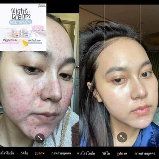 พร้อมส่ง🩷ครีมเอลลี่โมเมของแท้ ลดสิว ฝ้า กระ หน้าขาวกระจ่างใส ขนาด10กรัม~มีของแถม