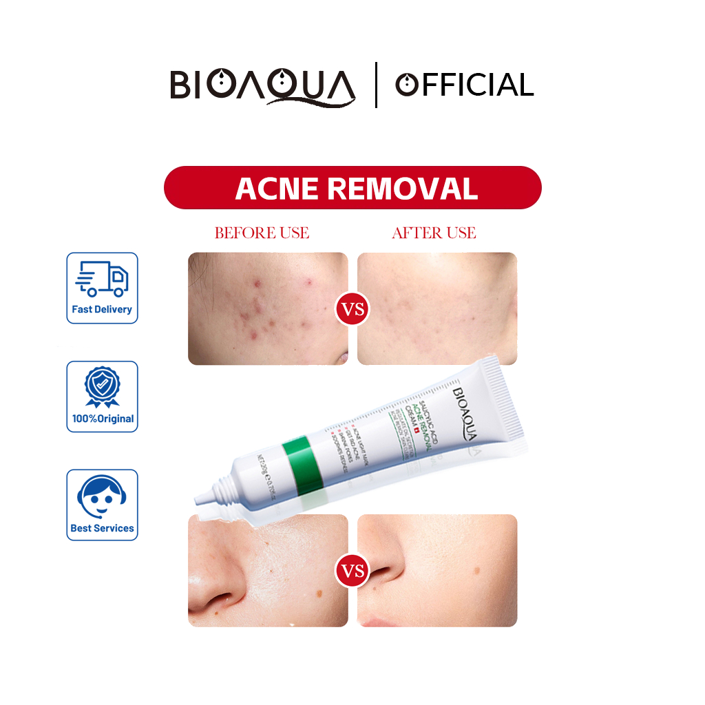 BIOAOUA Salicylic Acid Acne Removal Cream
