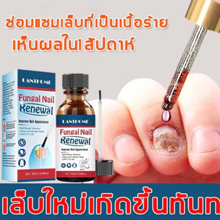 *ส่งจากไทย* Lanthome ยาเชื้อราเล็บ ซ่อมแซมเล็บเสีย 85052 กำจัดเล็บเสีย ดูแลเล็บ รักษาเล็บ