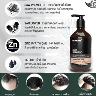 McKRIME Anti Hair Loss Formula Shampoo 200 ml แชมพูลดผมร่วง บำรุงรากผม หนังศีรษะ[หมดอายุ22/2/25]