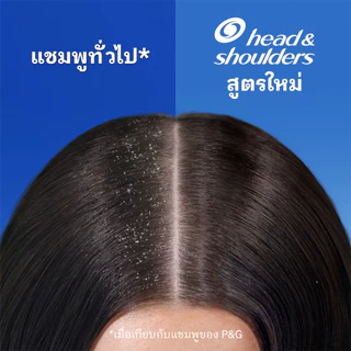 เฮดแอนด์โชว์เดอร์ แชมพูขจัดรังแค สูตรคูลเมนทอล 370 มล. แพ็คคู่