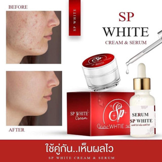 ครีมSP WHITE ครีมลดสิว ฝ้า ผิวหน้ากระจ่างใส