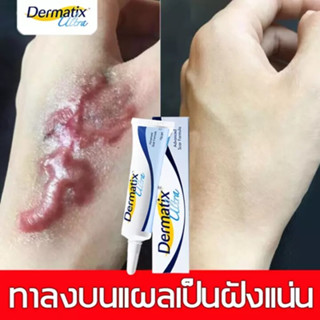 Dermatix Ultra Gel 15g ครีมแผลเป็น เจลซ่อมแซม