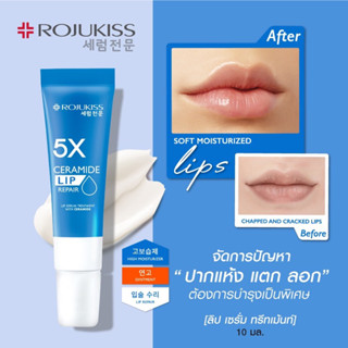 (ถูกมว๊วกก) Rojukiss 5X Lip Serum Treatment โรจูคิส 5เอ็กซ์ ลิป เซรั่ม ทรีทเม้นท์ ขนาด 10มล.