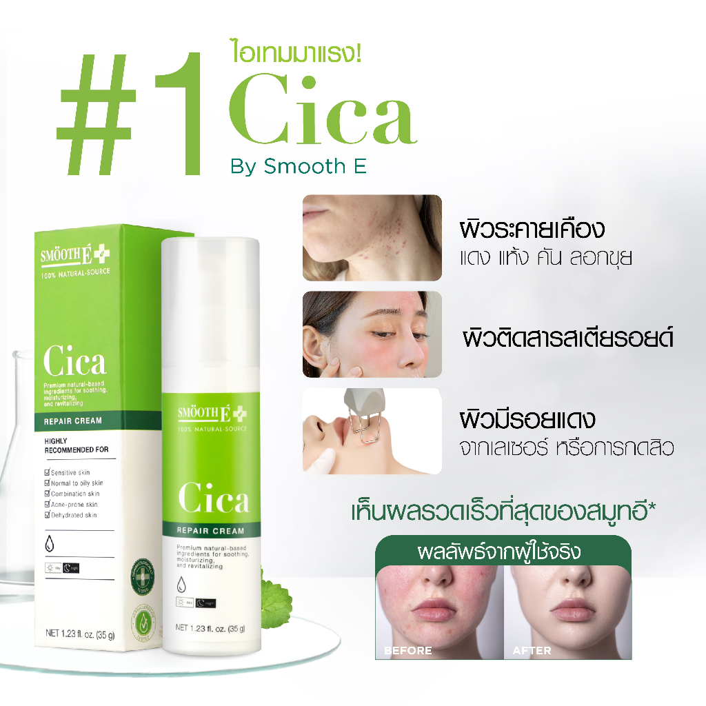 [สินค้าขายดี] Smooth E Cica Repair Cream 35g. ลดรอยแดง ผิวอักเสบ ลดผิวแพ้ง่าย แก้หลุมสิว ผิวแห้งเป็นขุย สมูทอี - รูปที่ 4