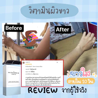 วิตามินผิวขาว หน้าขาว มีส่วนผสมของคอลลาเจน กลูต้าไธโอน กระจ่างใสทั้งตัวชุด 10 วัน