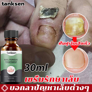 tanksen เซรั่มบำรุงเล็บ 30ml บำรุงเล็บ เชื้อราเล็บ เชื้อราที่เล็บเท้า เซรั่มดูแลเท้า เซรั่มทาเล็บ เซรั่มรักษาเล็บ